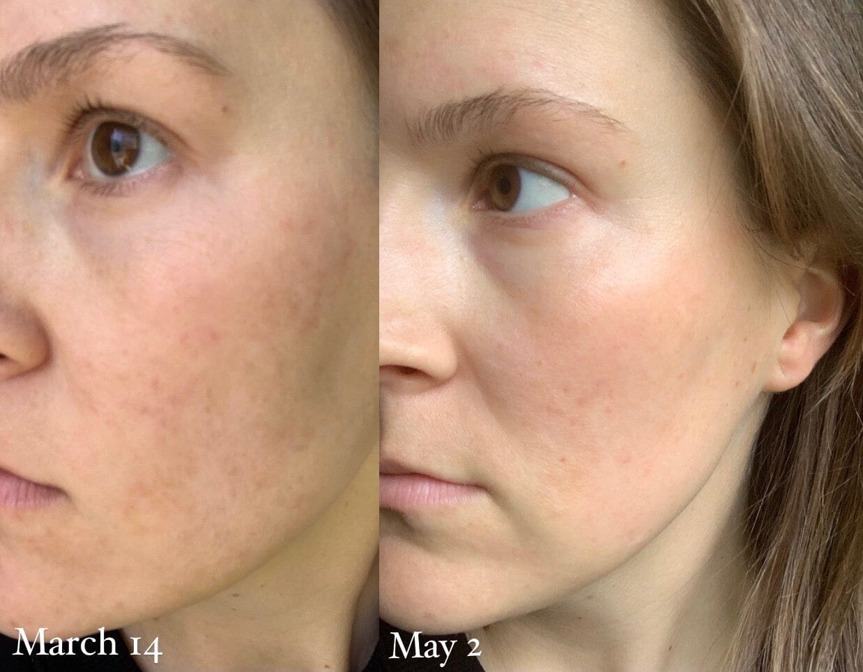 Sunnyside 15% Vitamin C Brightening Day Serum Retail IDF